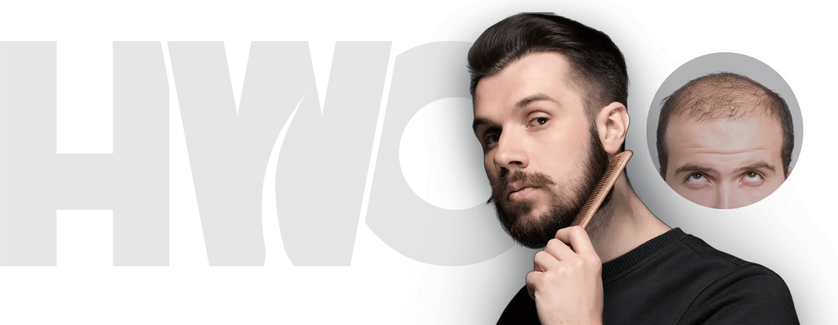 Best hair restoration procedures for hair loss in Kerala - Hair Wellness Clinic