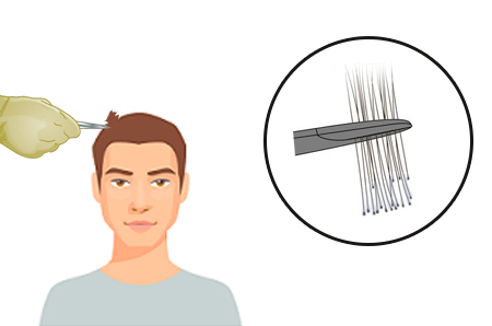 Hair loss testing