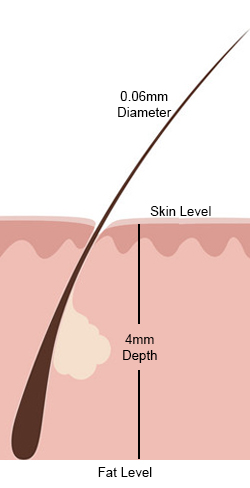 Structure of the hair